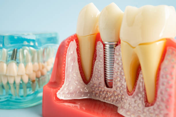 Best Dental Inlays and Onlays  in Greenville, NY